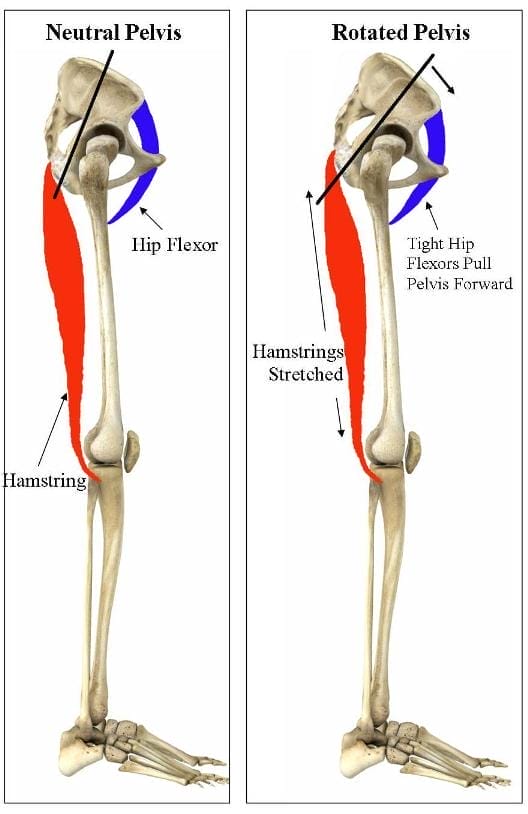 tight-hip-flexors